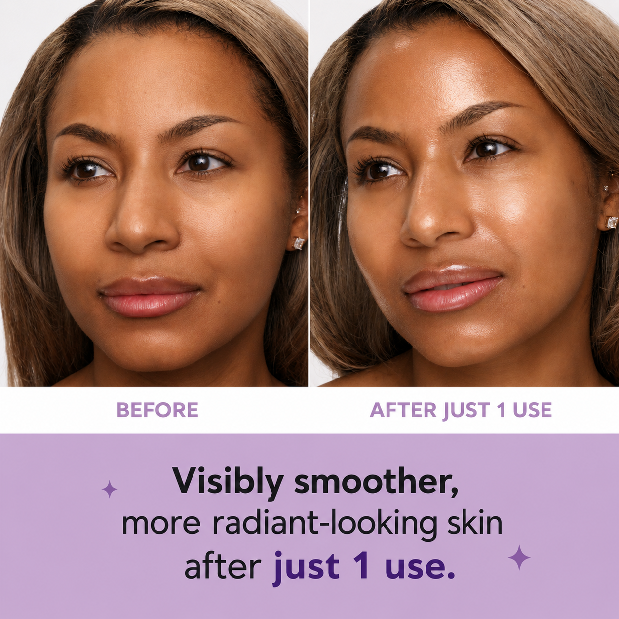AFTERTA® Collagen Tightening Face Patches